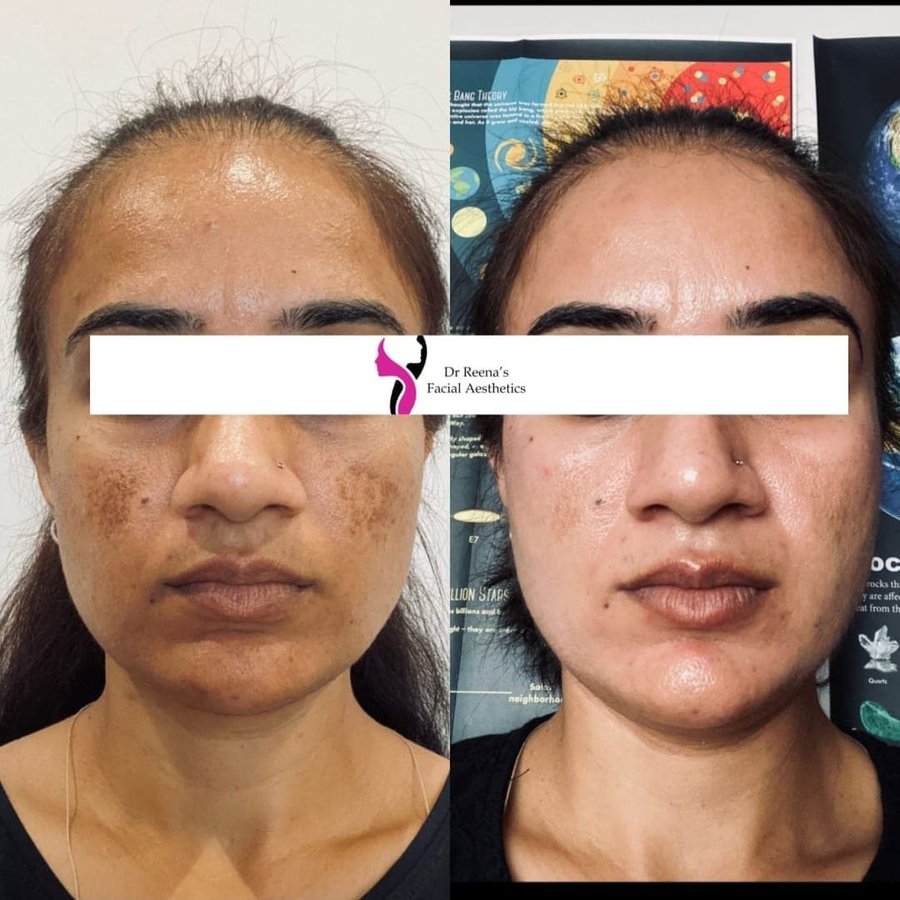 Dr Reena's Facial Aesthetics - Dr Reena's Facial Aesthetics