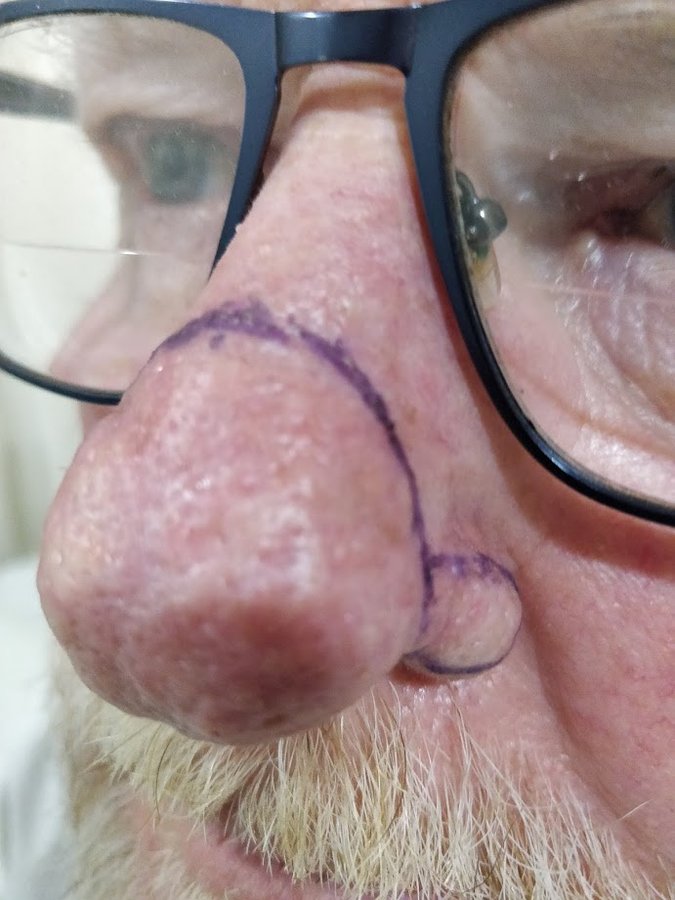 Dr. Rohit Krishna - Dr. Rohit Krishna