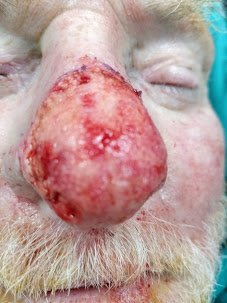 Dr. Rohit Krishna - Dr. Rohit Krishna