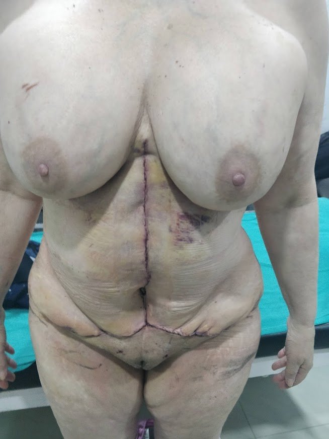 Dr. Rohit Krishna - Dr. Rohit Krishna