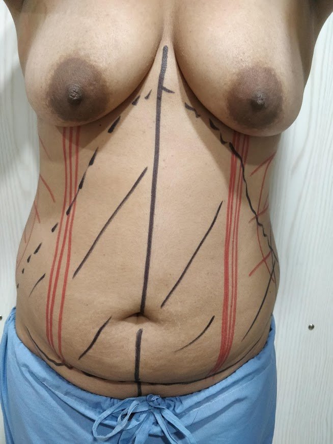 Dr. Rohit Krishna - Dr. Rohit Krishna