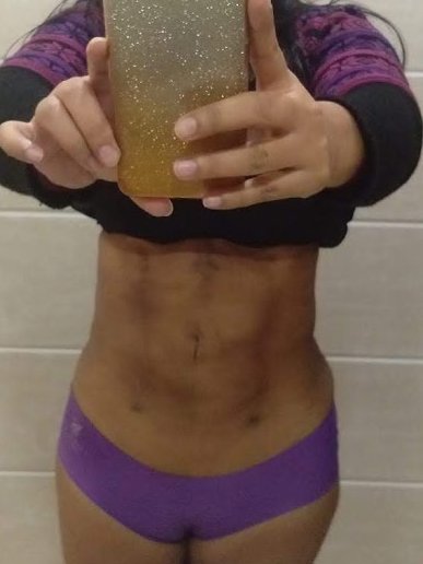 Dr. Rohit Krishna - Dr. Rohit Krishna