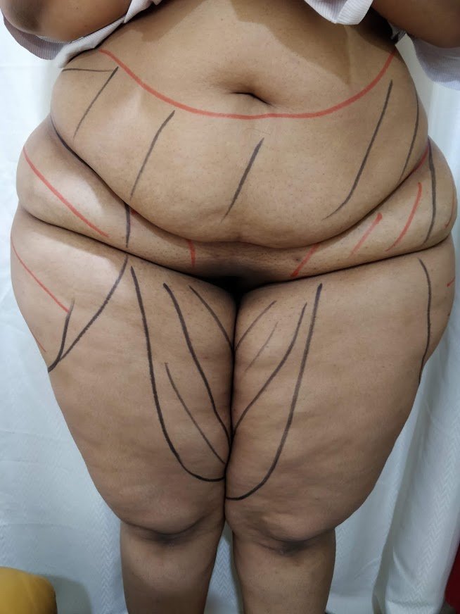 Dr. Rohit Krishna - Dr. Rohit Krishna