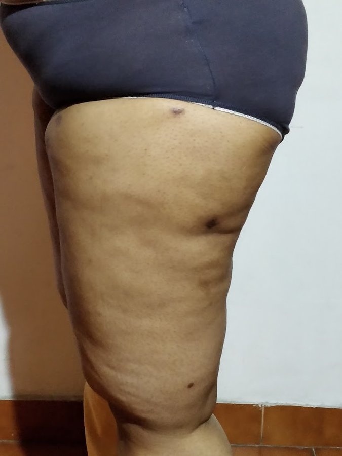 Dr. Rohit Krishna - Dr. Rohit Krishna