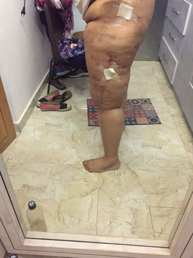 Dr. Rohit Krishna - Dr. Rohit Krishna