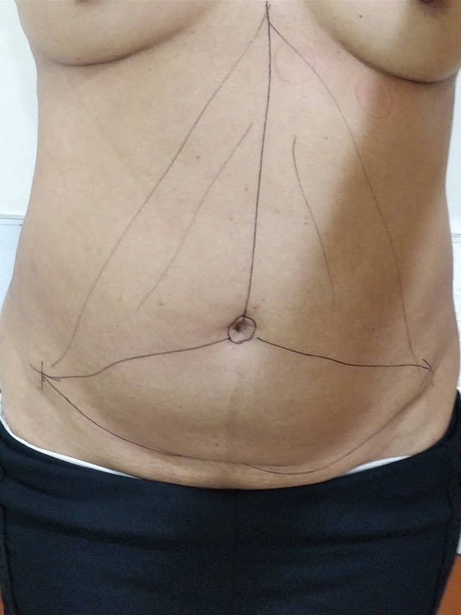 Dr. Rohit Krishna - Dr. Rohit Krishna