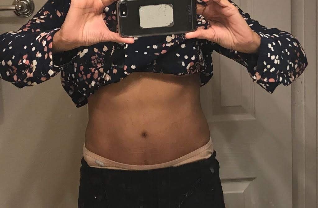 Dr. Rohit Krishna - Dr. Rohit Krishna