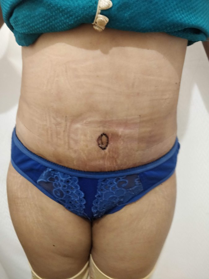 Dr. Rohit Krishna - Dr. Rohit Krishna