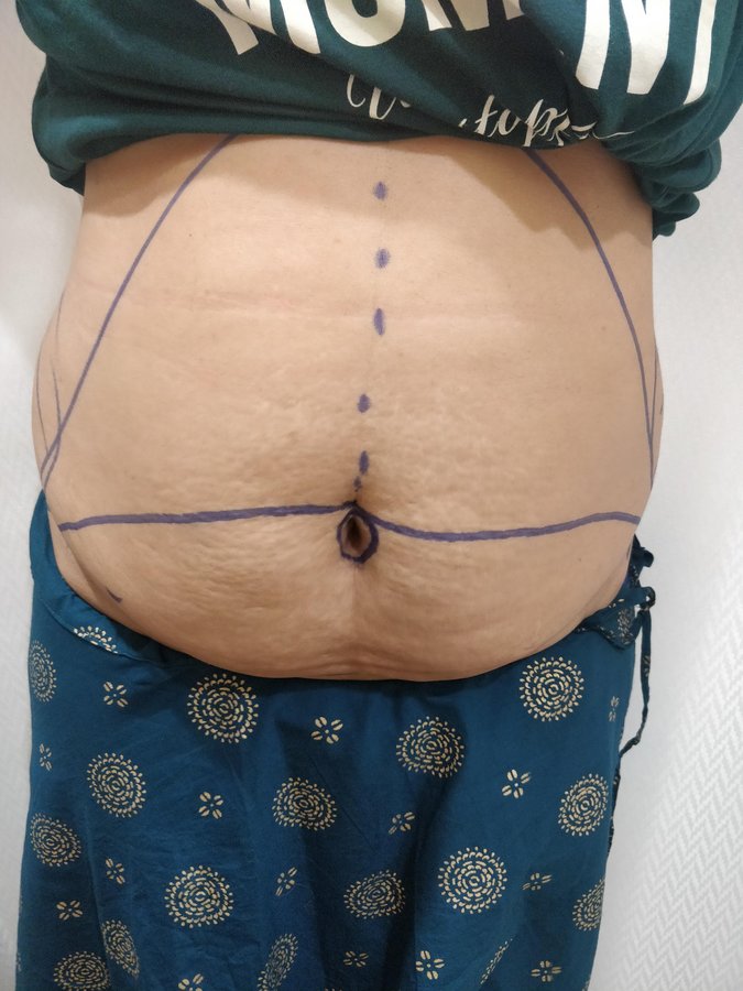 Dr. Rohit Krishna - Dr. Rohit Krishna