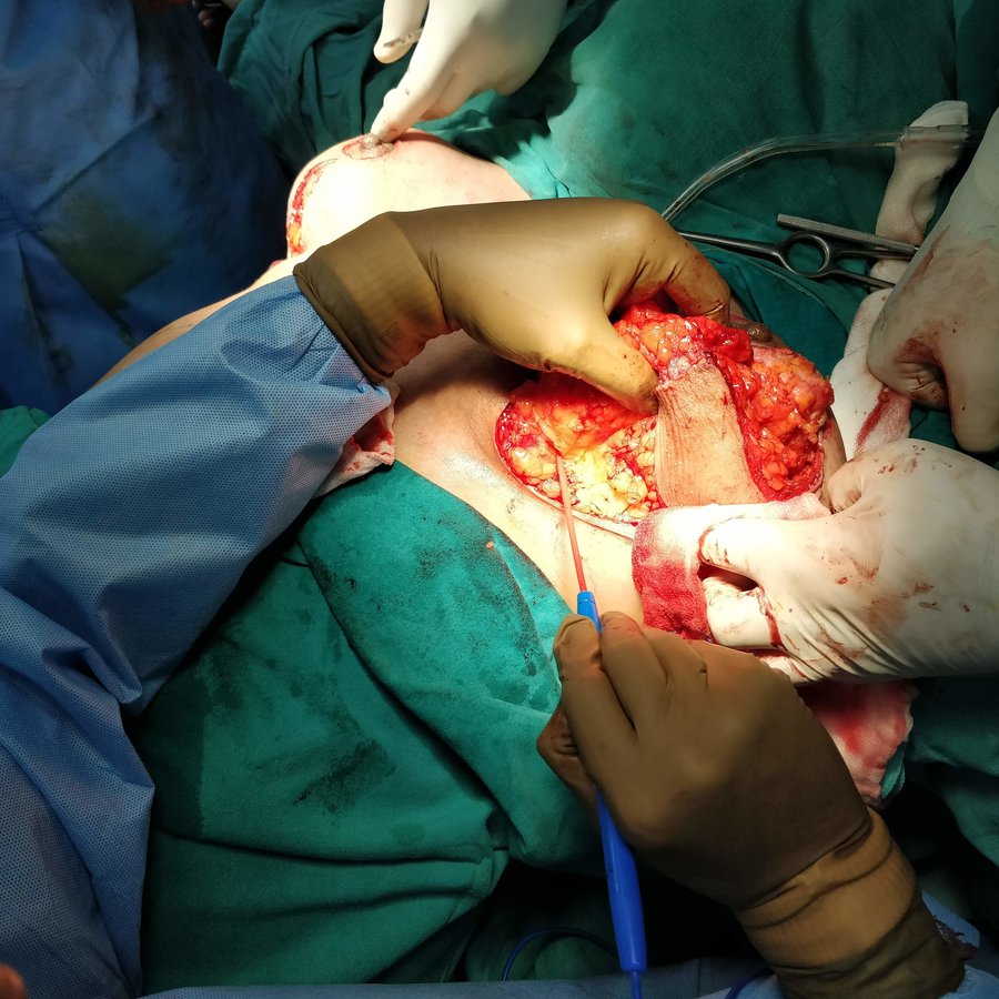 Dr. Rohit Krishna - Dr. Rohit Krishna