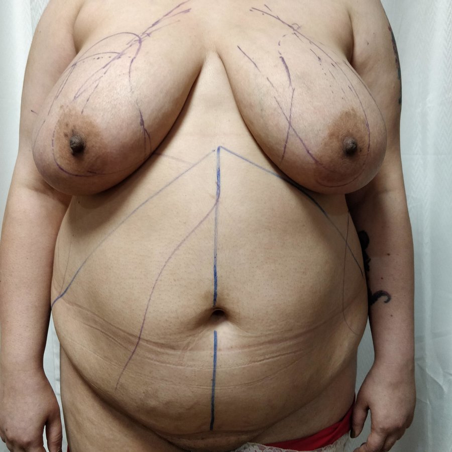 Dr. Rohit Krishna - Dr. Rohit Krishna