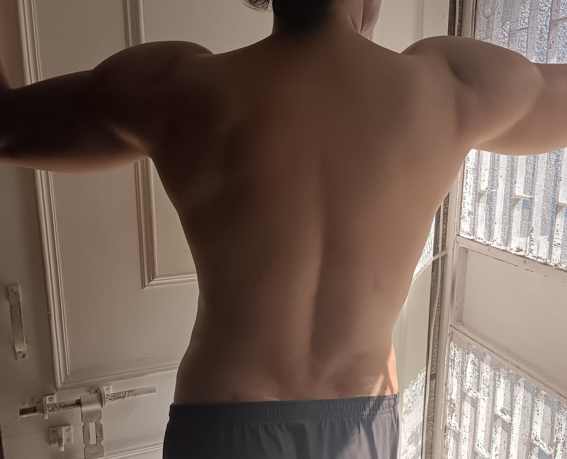 Dr. Rohit Krishna - Dr. Rohit Krishna