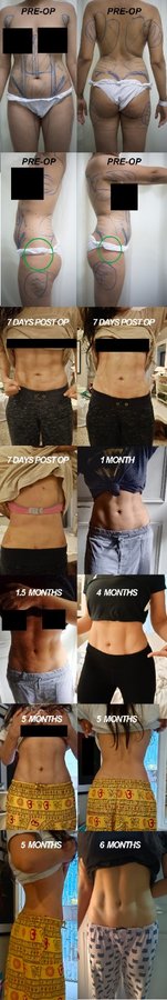 Dr. Rohit Krishna - Dr. Rohit Krishna