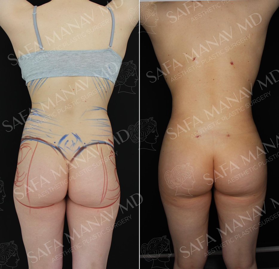 Dr Safa Manav - Dr Safa Manav