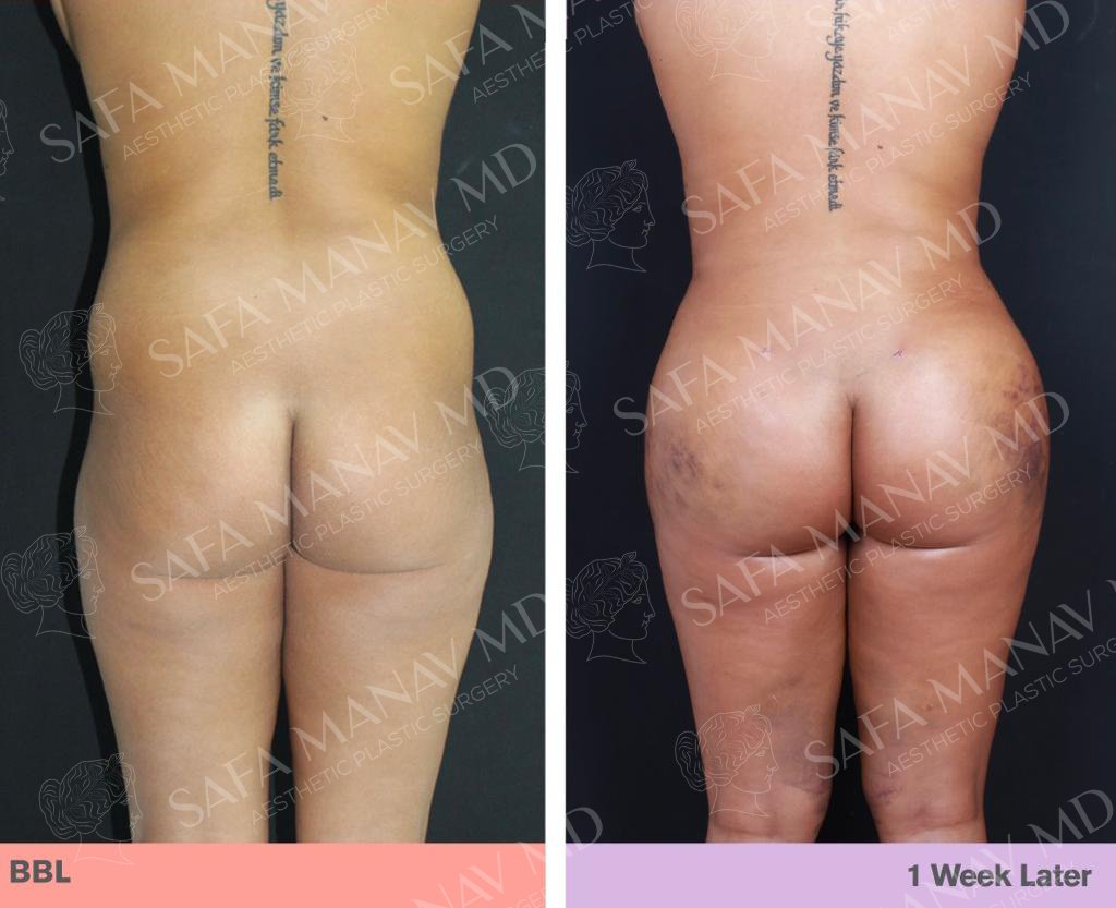 Dr Safa Manav - Dr Safa Manav