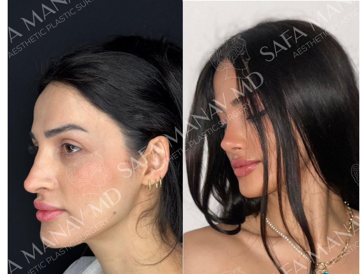 Dr Safa Manav - Dr Safa Manav