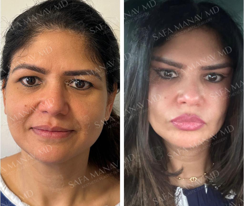 Dr Safa Manav - Dr Safa Manav