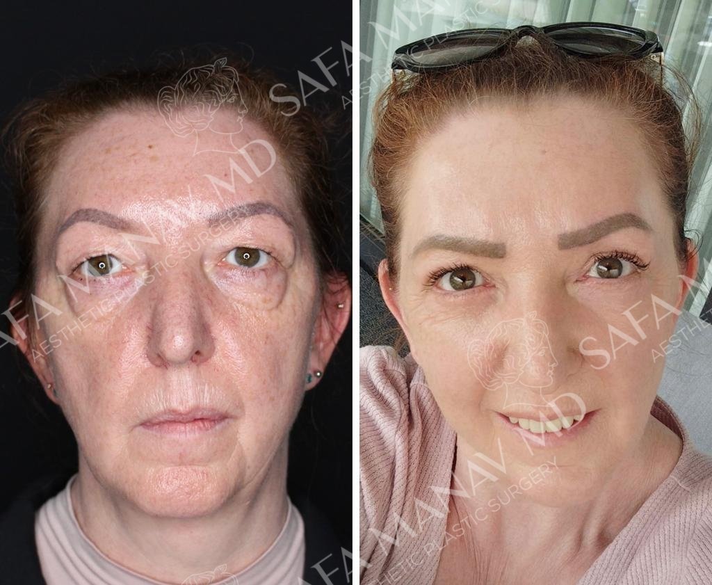 Dr Safa Manav - Dr Safa Manav