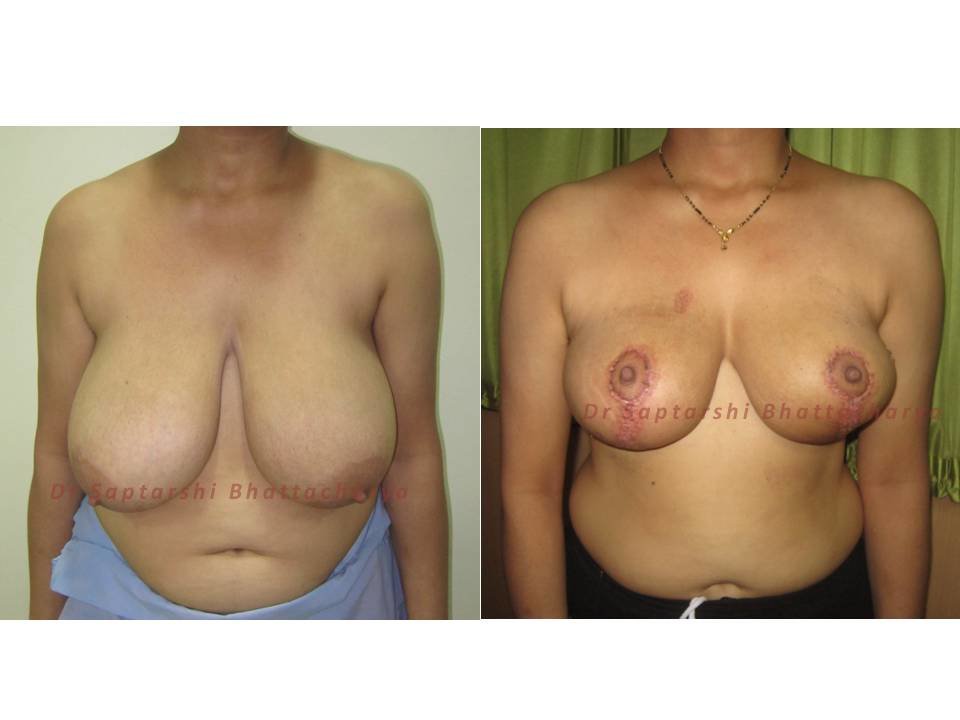 Dr Saptarshi Bhattacharya - Dr Saptarshi Bhattacharya