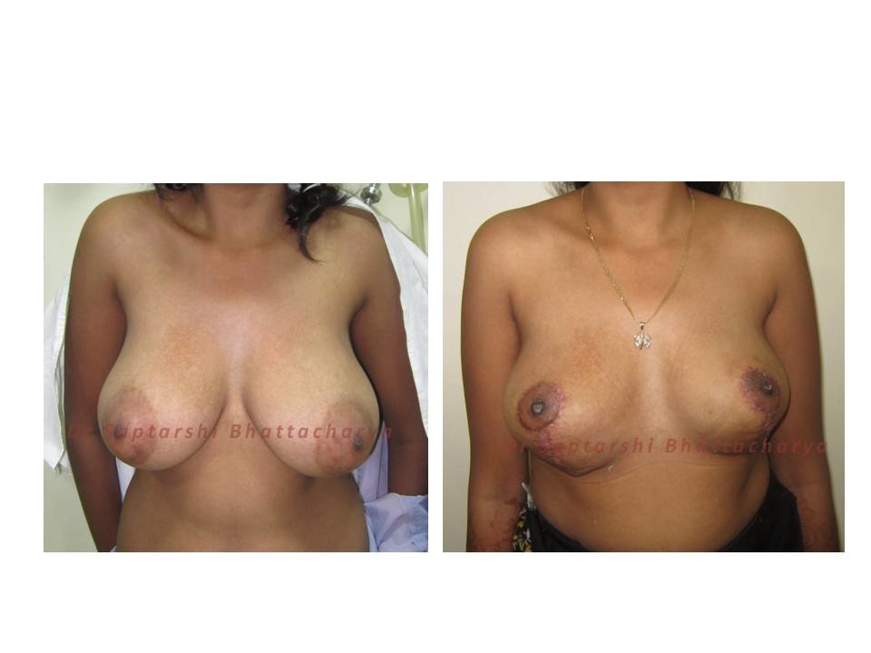 Dr Saptarshi Bhattacharya - Dr Saptarshi Bhattacharya