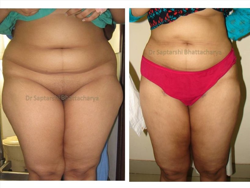 Dr Saptarshi Bhattacharya - Dr Saptarshi Bhattacharya