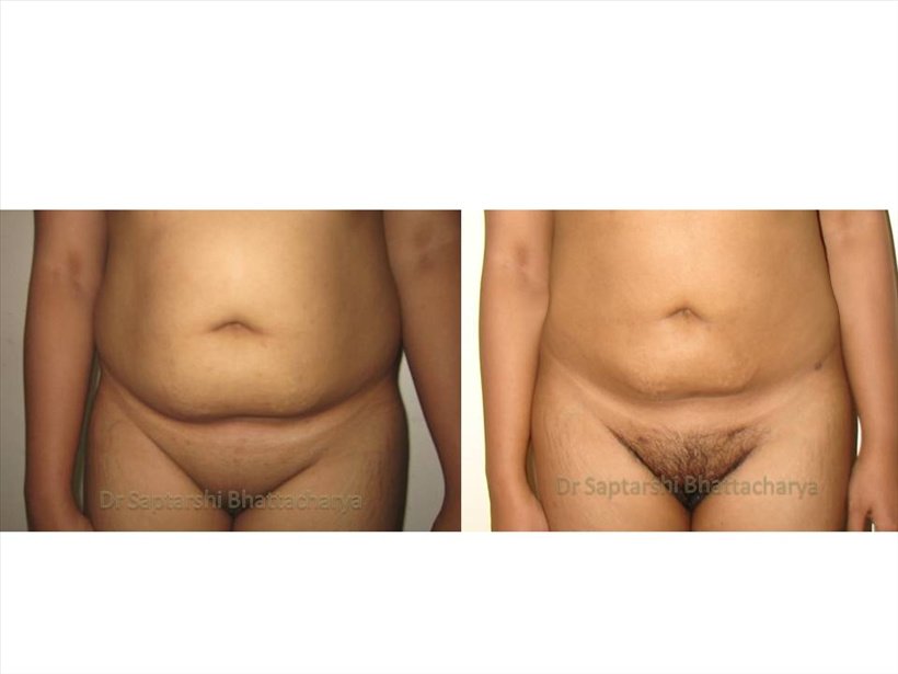 Dr Saptarshi Bhattacharya - Dr Saptarshi Bhattacharya