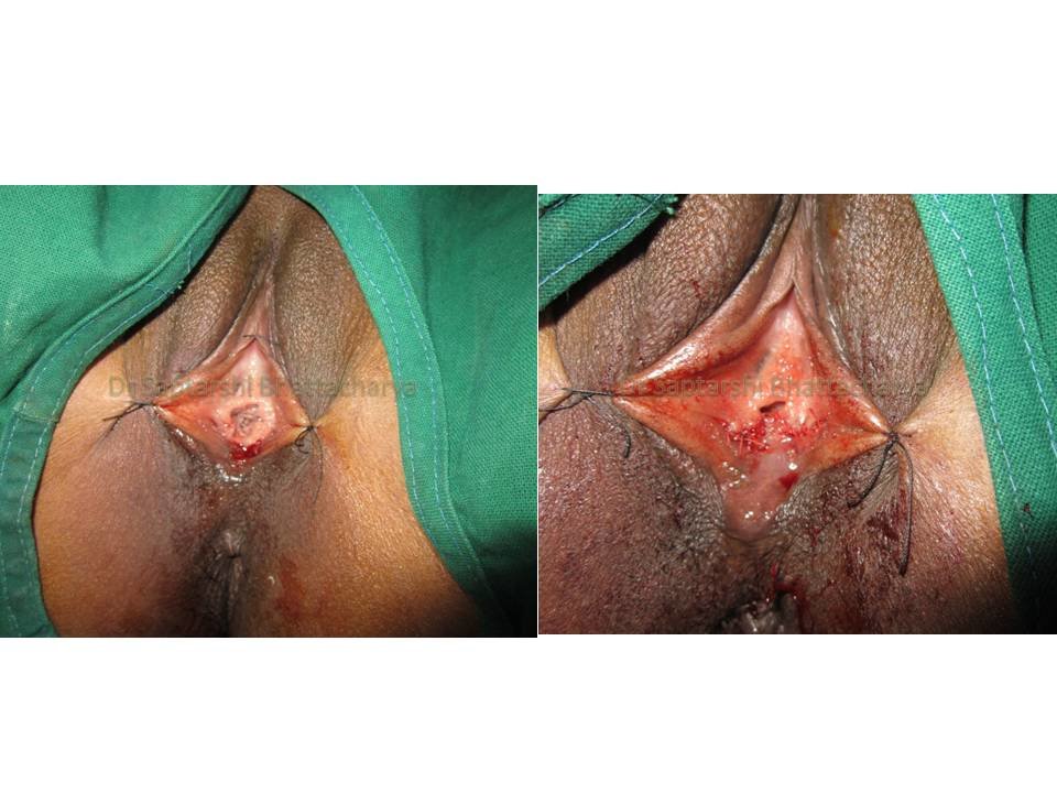 Dr Saptarshi Bhattacharya - Dr Saptarshi Bhattacharya