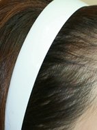 Dr. Shin-Je Lee (Dr. Momo) Hair Transplant International - Dr. Shin-Je Lee (Dr. Momo) Hair Transplant International