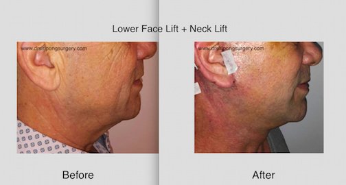 Dr Siripong Surgery - Dr Siripong Surgery