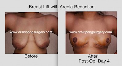 Dr Siripong Surgery - Dr Siripong Surgery
