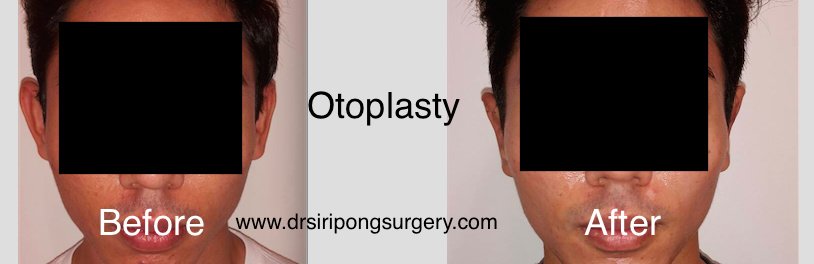 Dr Siripong Surgery - Dr Siripong Surgery