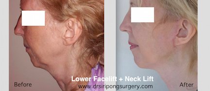 Dr Siripong Surgery - Dr Siripong Surgery