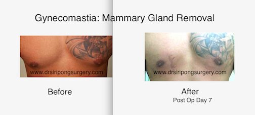 Dr Siripong Surgery - Dr Siripong Surgery