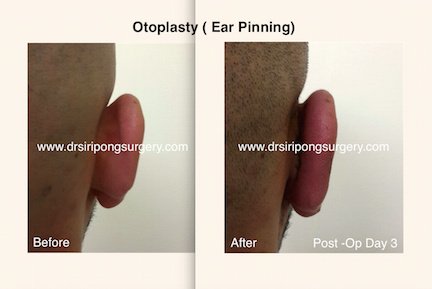 Dr Siripong Surgery - Dr Siripong Surgery