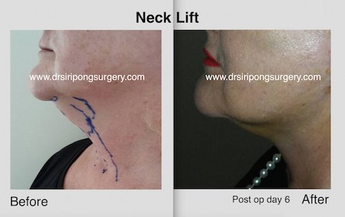 Dr Siripong Surgery - Dr Siripong Surgery