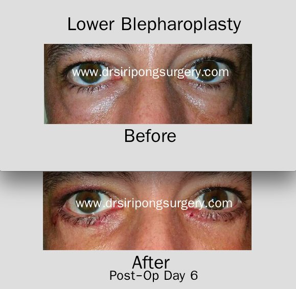 Dr Siripong Surgery - Dr Siripong Surgery