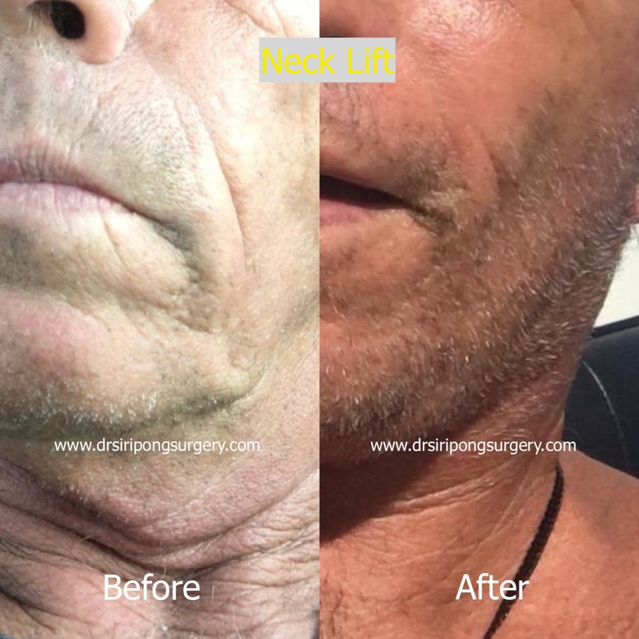 Dr Siripong Surgery - Dr Siripong Surgery