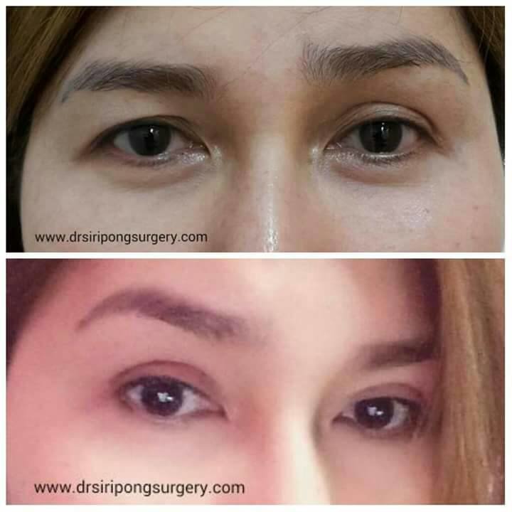 Dr Siripong Surgery - Dr Siripong Surgery