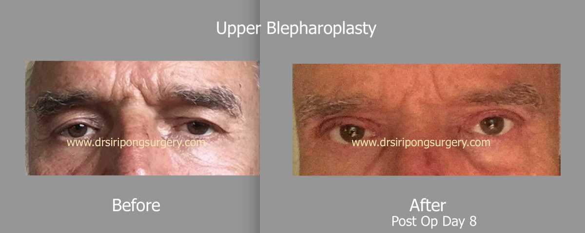 Dr Siripong Surgery - Dr Siripong Surgery