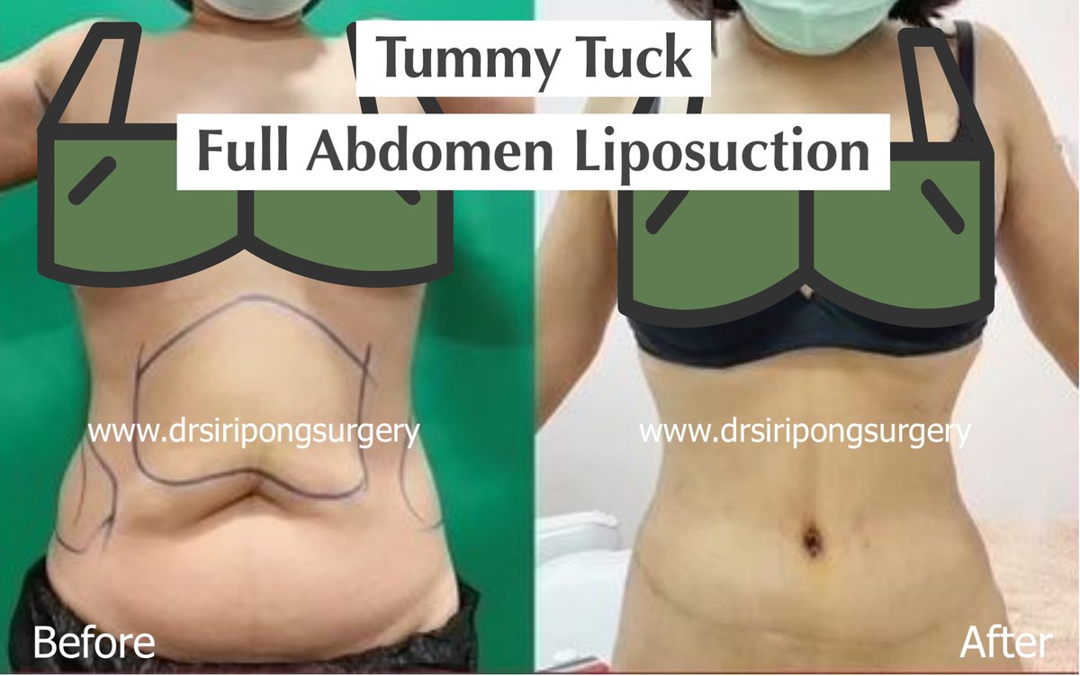 Dr Siripong Surgery - Dr Siripong Surgery