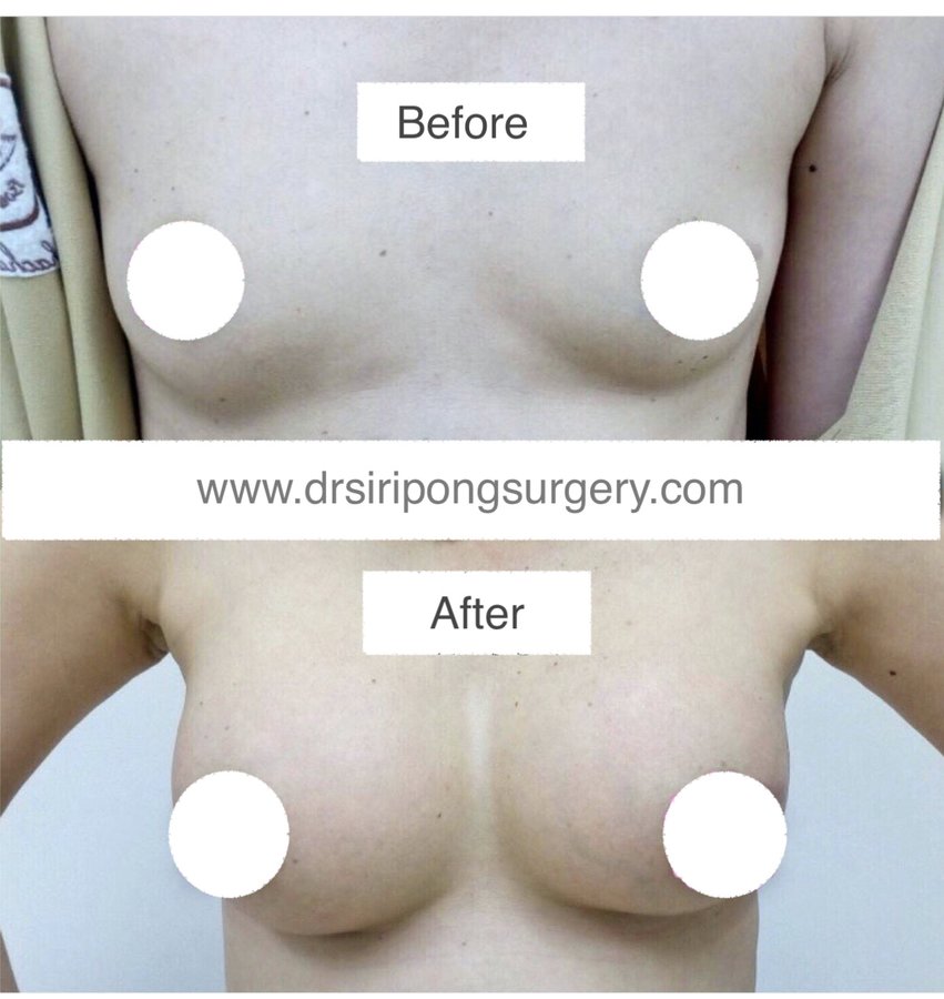 Dr Siripong Surgery - Dr Siripong Surgery