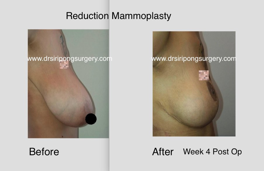 Dr Siripong Surgery - Dr Siripong Surgery