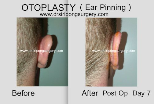 Dr Siripong Surgery - Dr Siripong Surgery