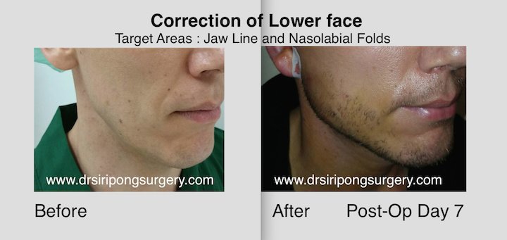 Dr Siripong Surgery - Dr Siripong Surgery