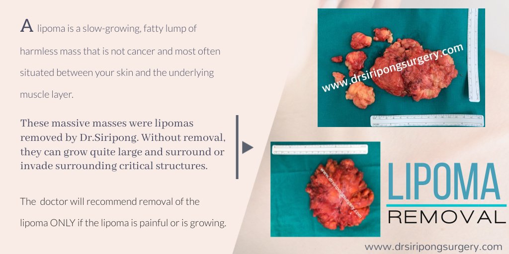 Dr Siripong Surgery - Dr Siripong Surgery