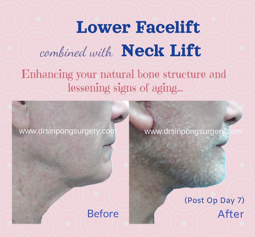 Dr Siripong Surgery - Dr Siripong Surgery