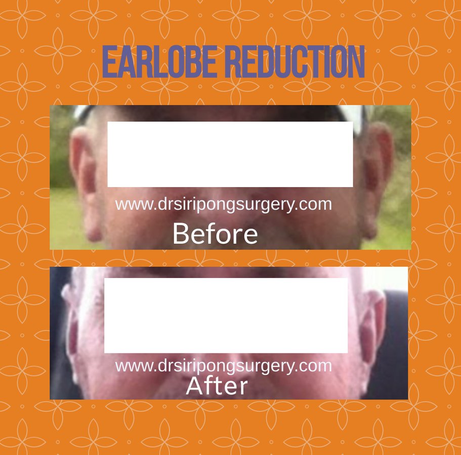 Dr Siripong Surgery - Dr Siripong Surgery