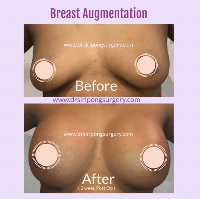 Dr Siripong Surgery - Dr Siripong Surgery