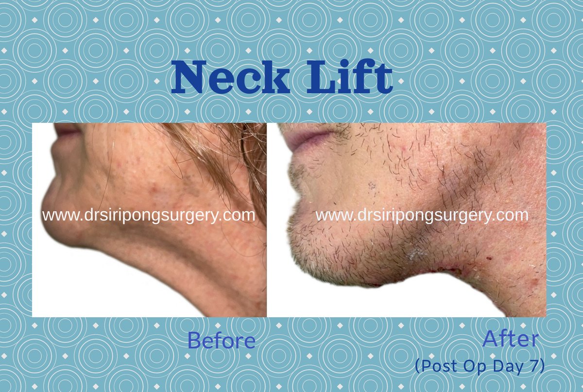 Dr Siripong Surgery - Dr Siripong Surgery