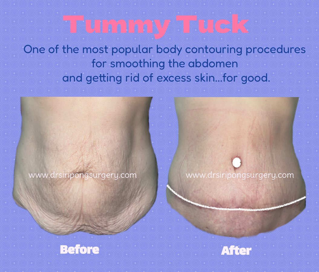 Dr Siripong Surgery - Dr Siripong Surgery